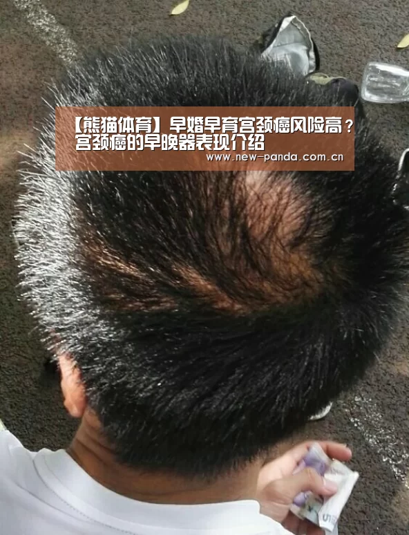 【熊猫体育】早婚早育宫颈癌风险高？ 宫颈